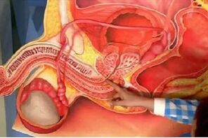 массаж простаты для увеличения толщины полового члена